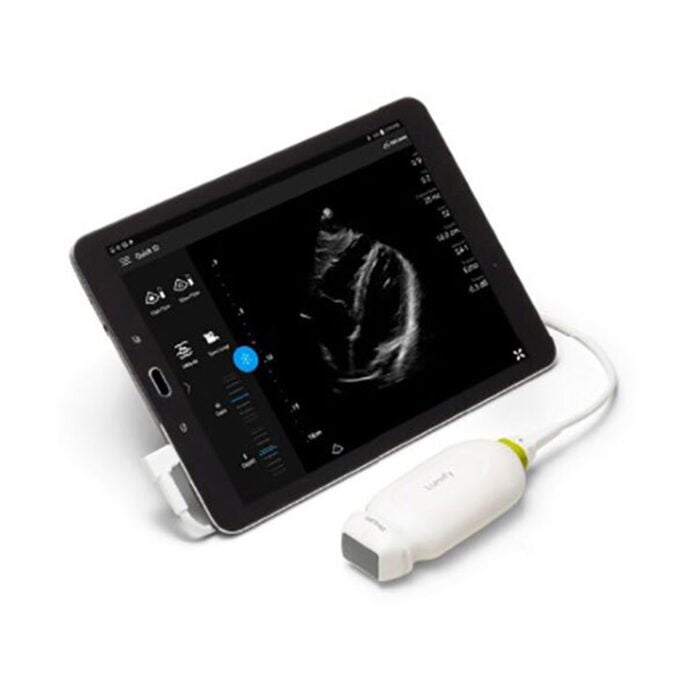Lumify Ultrasound System