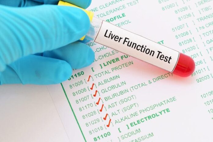 Liver Function Tests