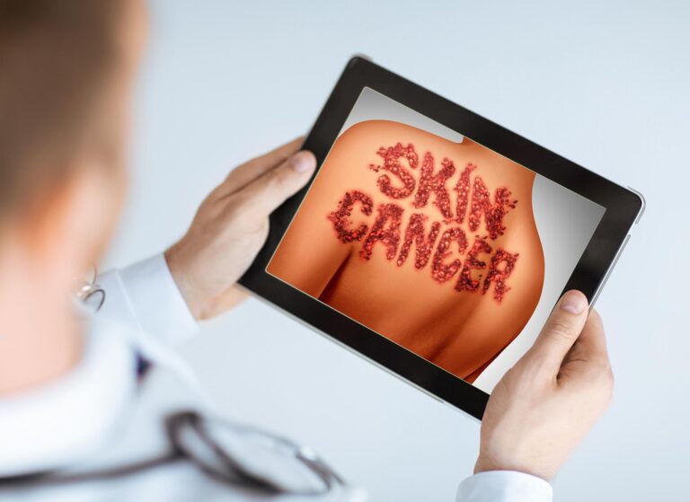 Skin Cancer Diagnosis Apps