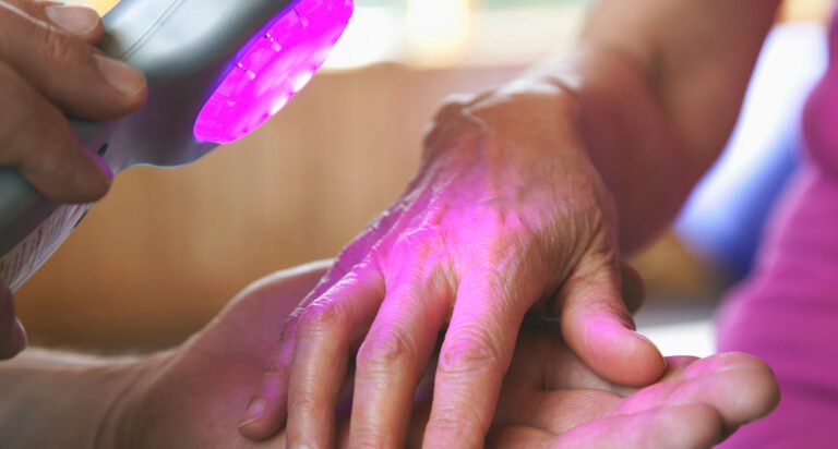 Photo-Therapy To Manage Psoriasis: All That You Need To Know