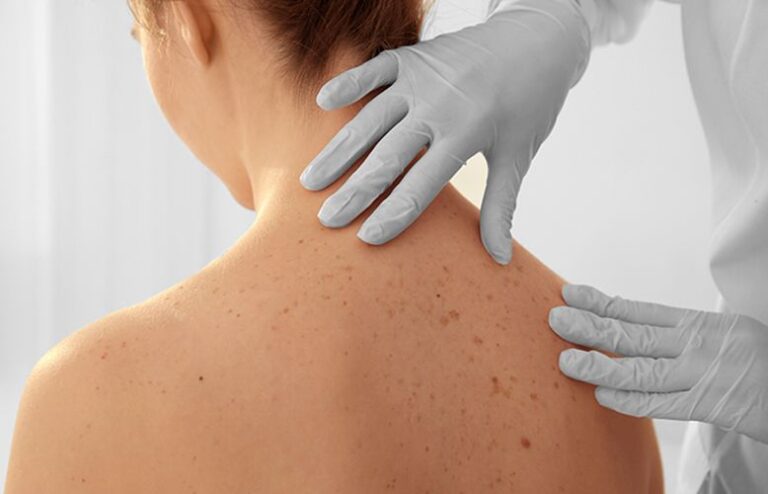 Products That Will Tell You How to Get Rid of Back Acne This Summer