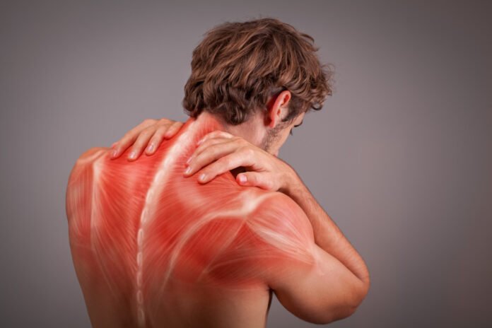 Muscle Trigger Point Anatomy