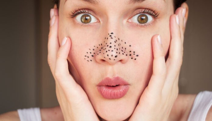 The 20 At-Home Best Deep Cleansing Face Masks for Blackheads The 20 At-Home Best Deep Cleansing Face Masks for Blackheads