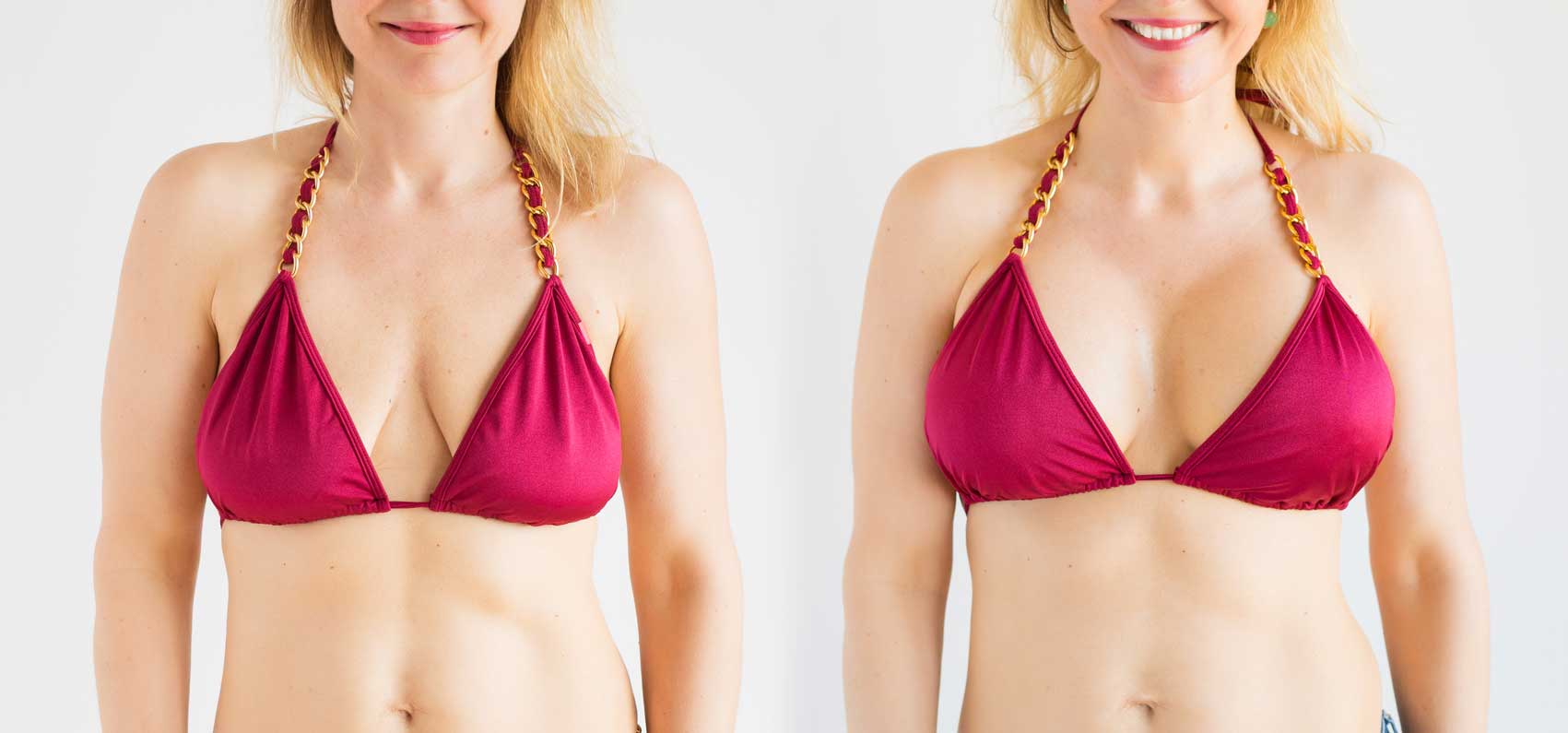 don-t-want-surgery-here-are-10-non-surgical-breast-lift-alternatives