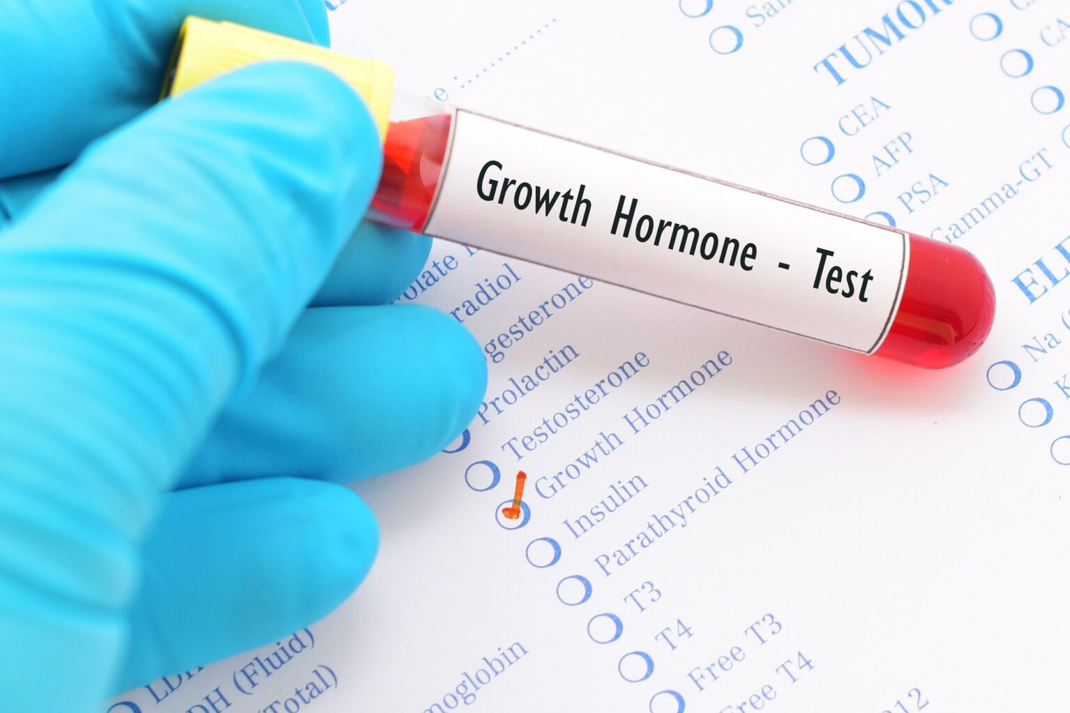 Growth Hormone Deficiency Diagnosis Beauty & Medical Devices