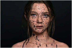 skintypes