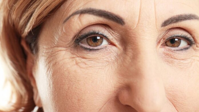 How To Get Rid Of Wrinkles: 10 Natural Treatments & Home Remedies