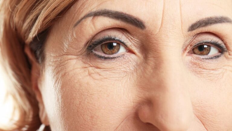 How To Get Rid Of Wrinkles: 10 Natural Treatments & Home Remedies