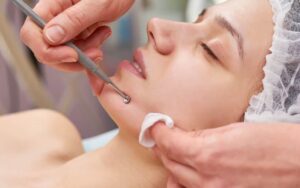 Beauty bloggers are talking about a small beauty tool called a Comedone Extractor.