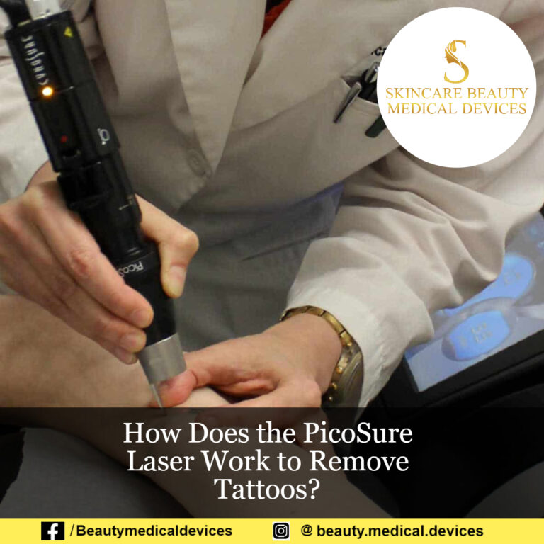 How Does the PicoSure Laser Work to Remove Tattoos?