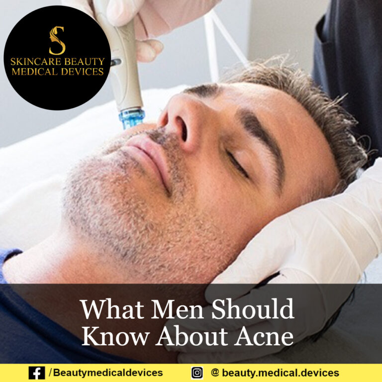 What Men Should Know About Acne