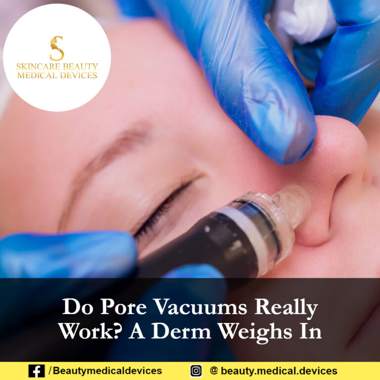 Do Pore Vacuums Really Work? A Derm Weighs In