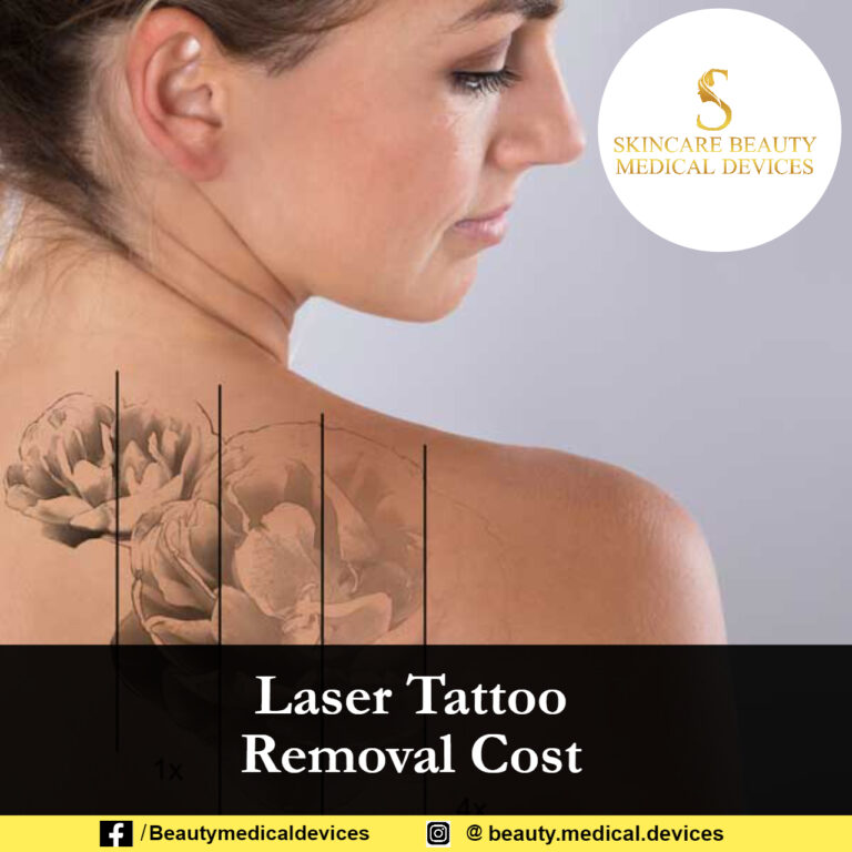 Laser Tattoo Removal Cost