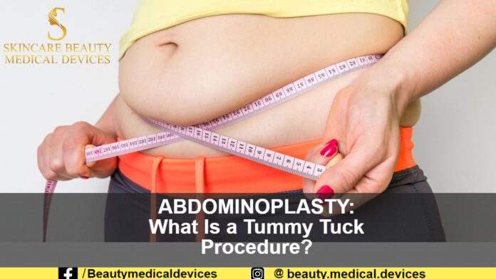 ABDOMINOPLASTY: What Is a Tummy Tuck Procedure?