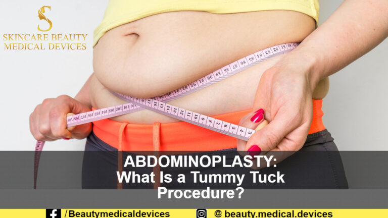 ABDOMINOPLASTY: What Is a Tummy Tuck Procedure?