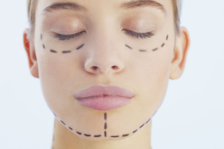 Things To Consider Before Getting A Cosmetic Procedure