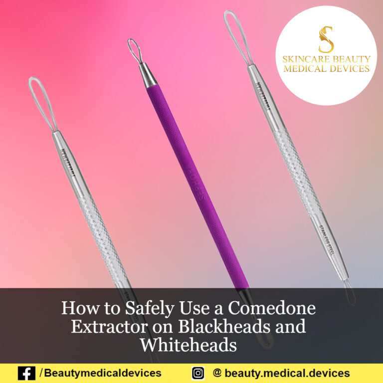 How to Safely Use a Comedone Extractor on Blackheads and Whiteheads