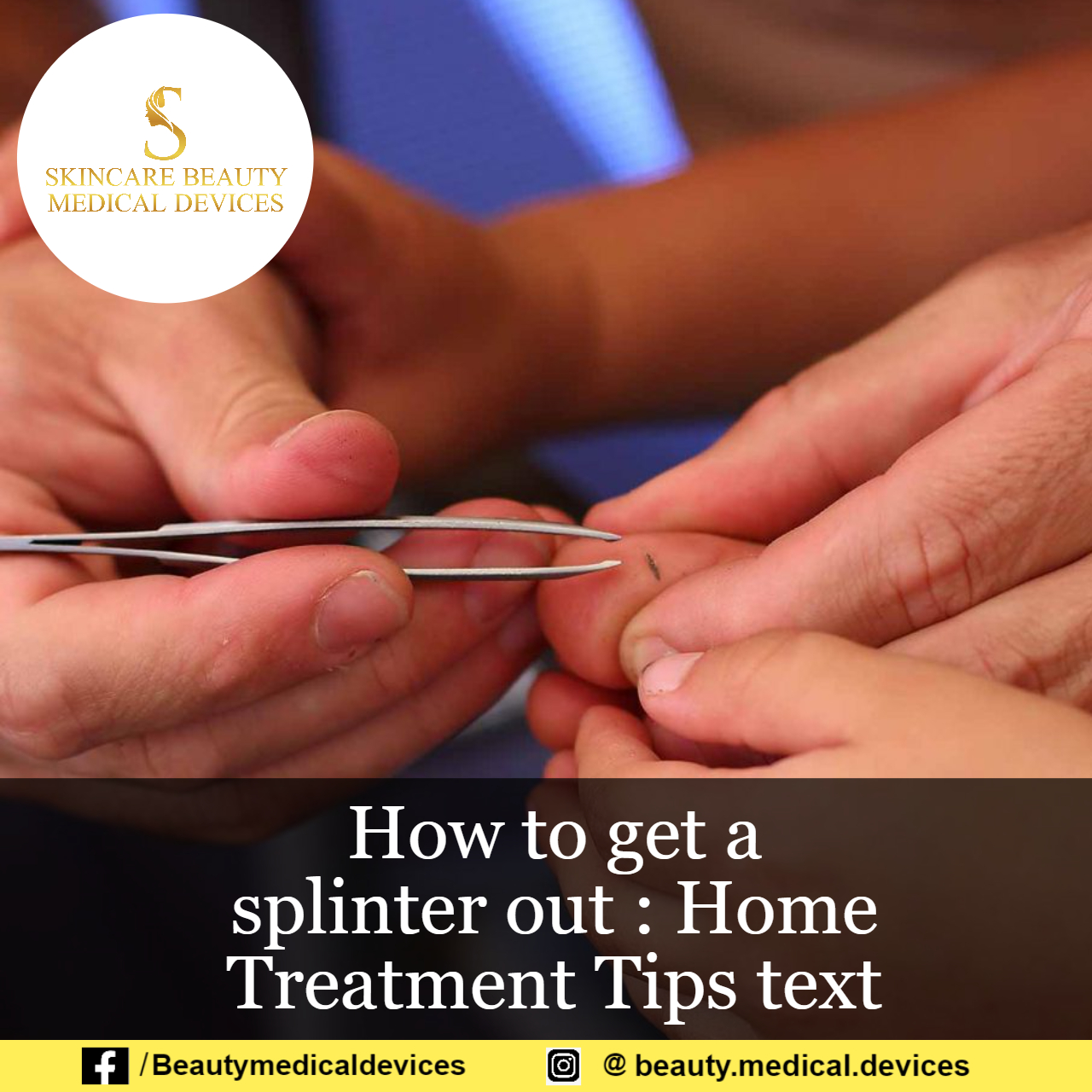 How to get a splinter out Treatments you can do at home