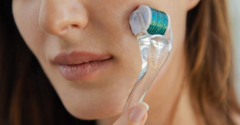 How to use Derma Roller For Acne Scars ?