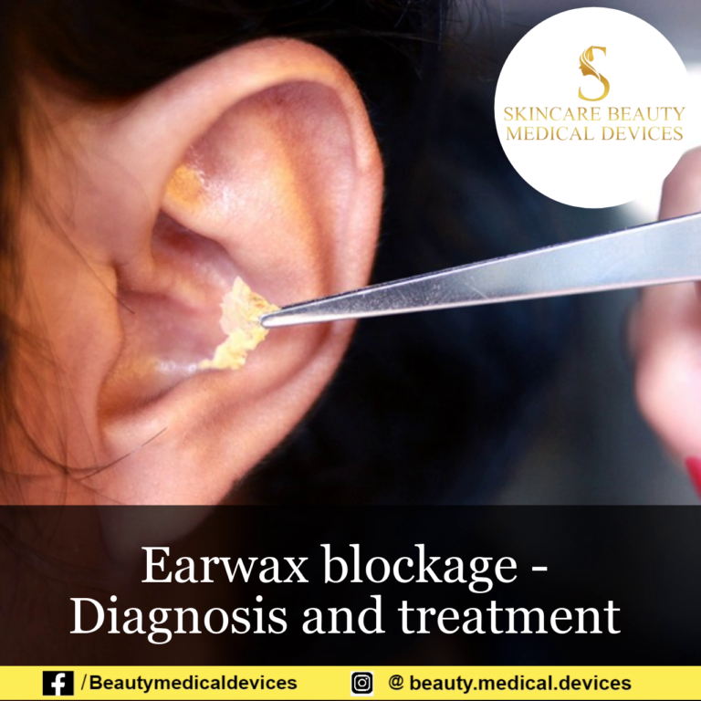 Earwax blockage – Diagnosis and treatment