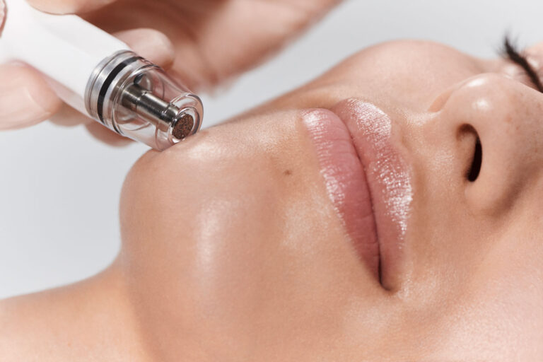 Reveal Your Radiance Through Diamond Glow aka Dermalinfusion
