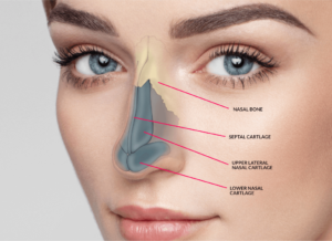 Rhinoplasty is a surgery.