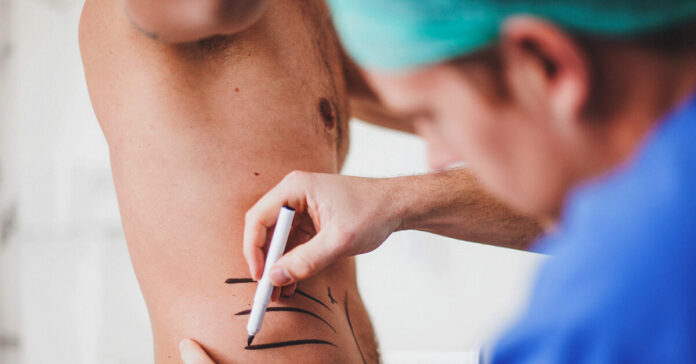 What Is Emsculpt? Here's Everything You Need to Know About the Body-Contouring Treatment