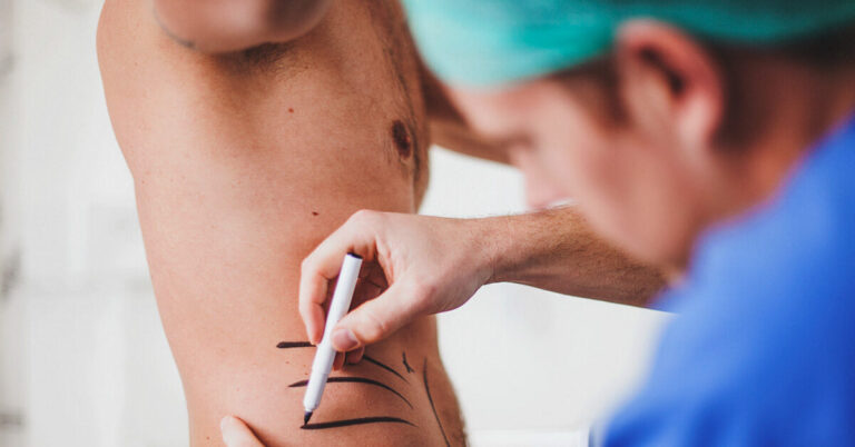 What Is Emsculpt? You Need to Know About the Body-Contouring Treatment