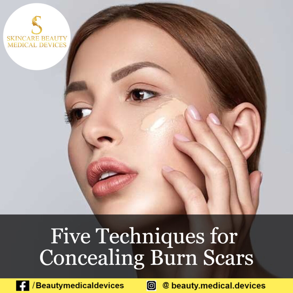Five Techniques for Concealing Burn Scars Beauty