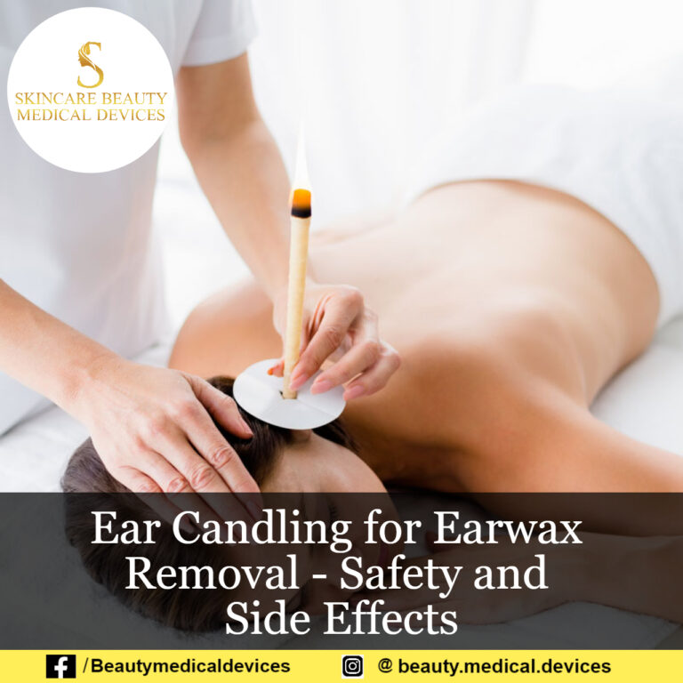 Ear Candling for Earwax Removal – Safety and Side Effects