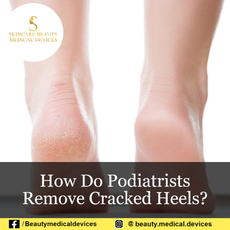 How Do Podiatrists Remove Cracked Heels?