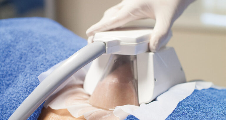 WHAT IS CRYOLIPOLYSIS AND HOW DOES IT WORK?