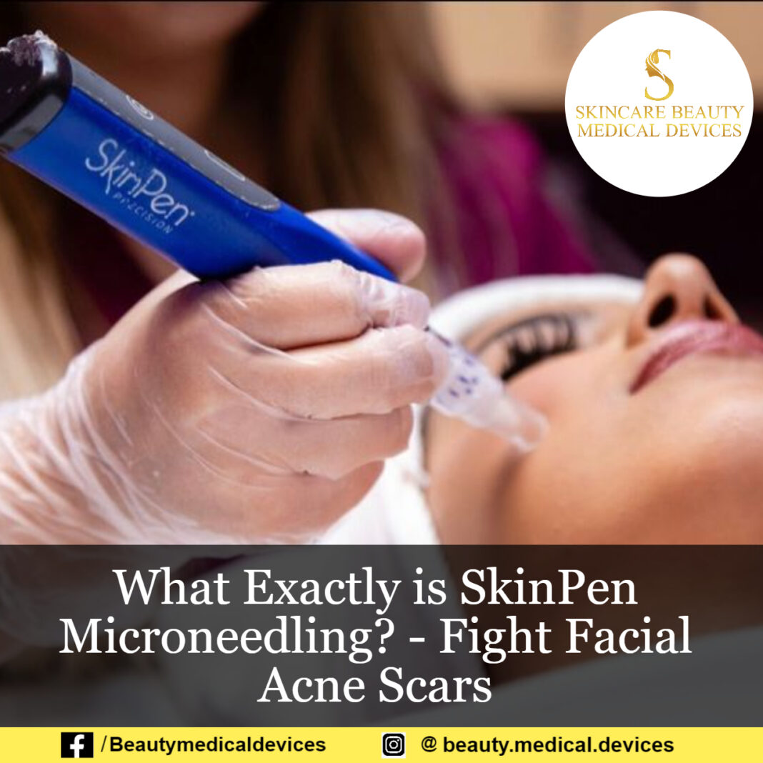 What Exactly is SkinPen Microneedling? Fight Facial Acne Scars