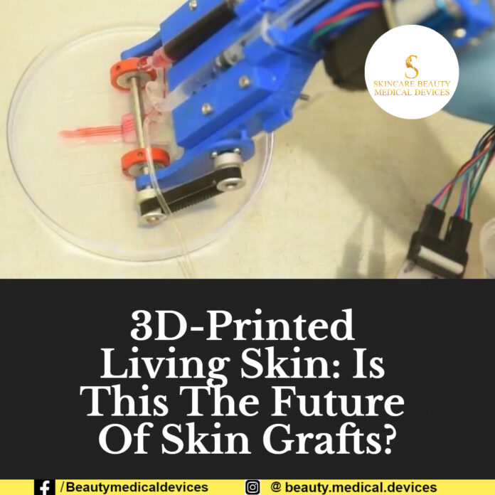 3D-Printed Living Skin: Is This The Future Of Skin Grafts? 3D-Printed Living Skin: Is This The Future Of Skin Grafts?