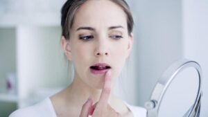 Everything You Need to Know In Healing Your Chapped Lips
