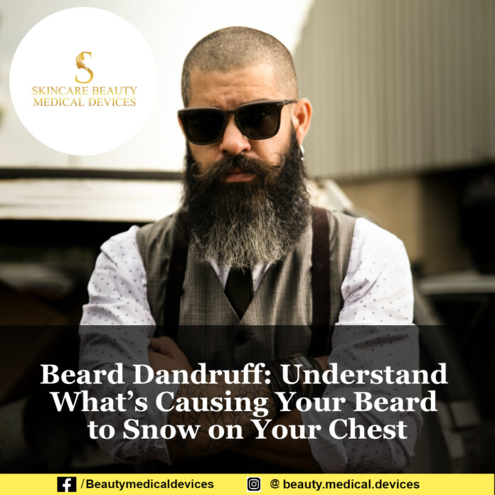 Beard Dandruff: Understand What’s Causing Your Beard to Snow on Your Chest