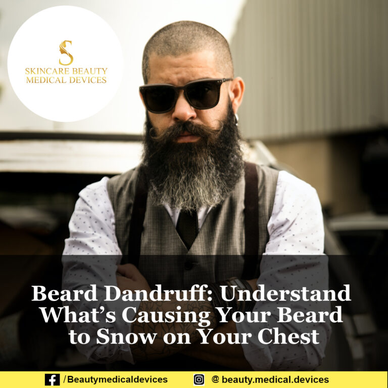 Beard Dandruff: Understand What’s Causing Your Beard to Snow on Your Chest