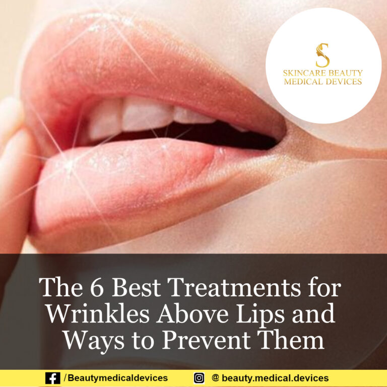 The 6 Best Treatments for Wrinkles Above Lips and Ways to Prevent Them