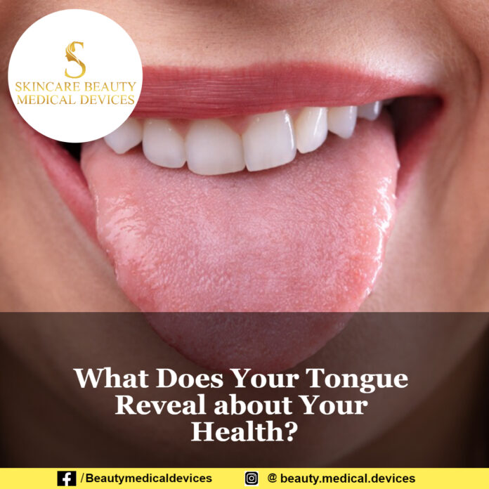 What Does Your Tongue Reveal about Your Health?