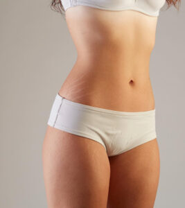 Techniques for Hiding Stretch Marks