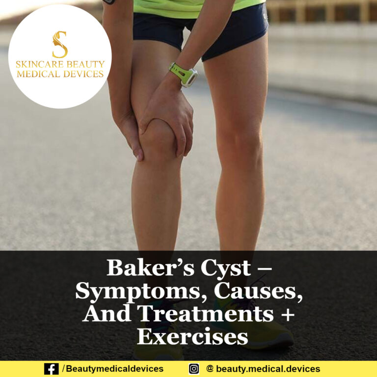 Baker’s Cyst Symptoms, Causes, And Treatments + Exercises
