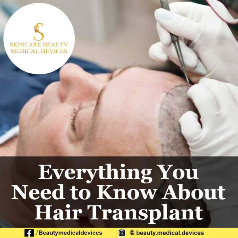 Everything You Need to Know About Hair Transplant