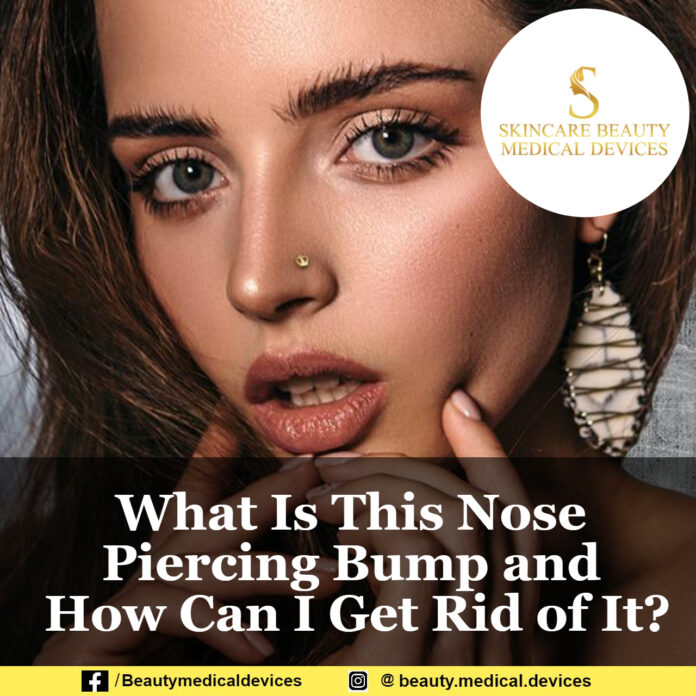 What Is This Nose Piercing Bump and How Can I Get Rid of It?