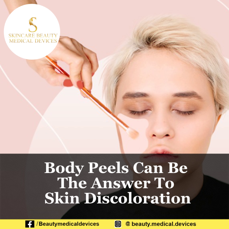 Body Peels Can Be The Answer To Skin Discoloration