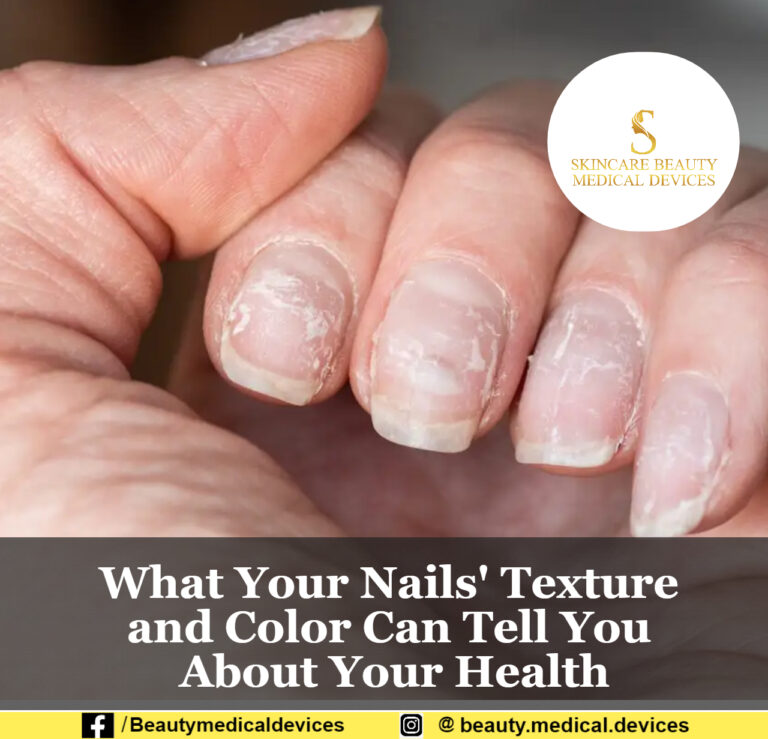 What Your Nails’ Texture and Color Can Tell You About Your Health