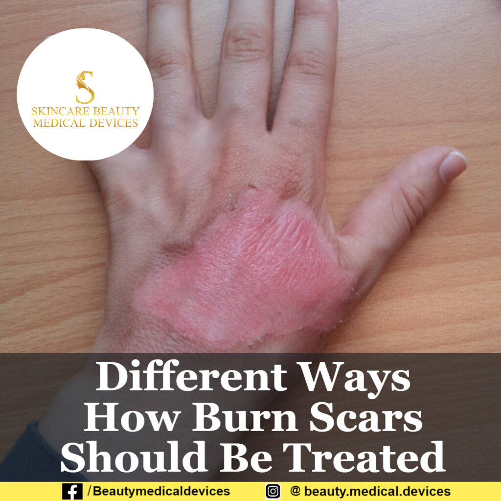 Different Ways How Burn Scars Should Be Treated