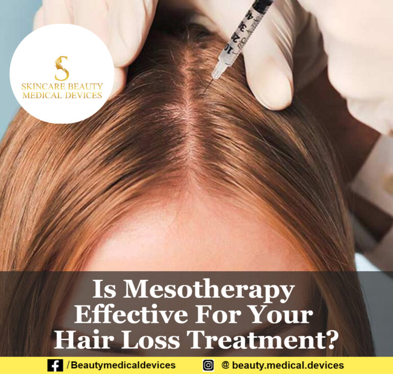 Is Mesotherapy Effective For Your Hair Loss Treatment?