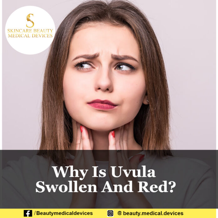 Why Is Uvula Swollen And Red?