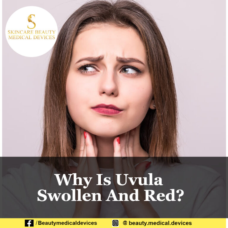 Why Is Uvula Swollen And Red? Beauty Medical Devices