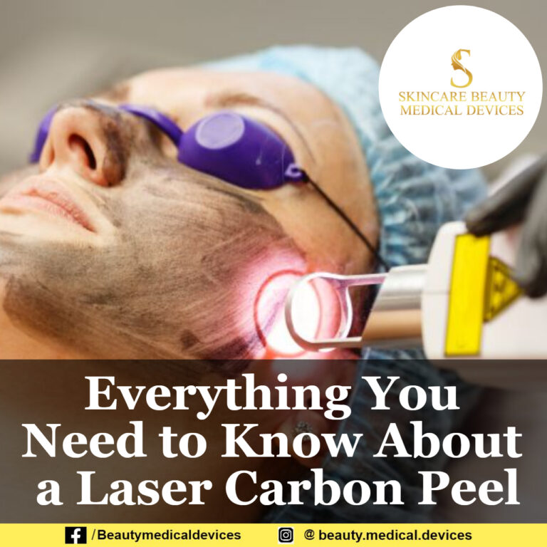 Everything You Need to Know About a Laser Carbon Peel